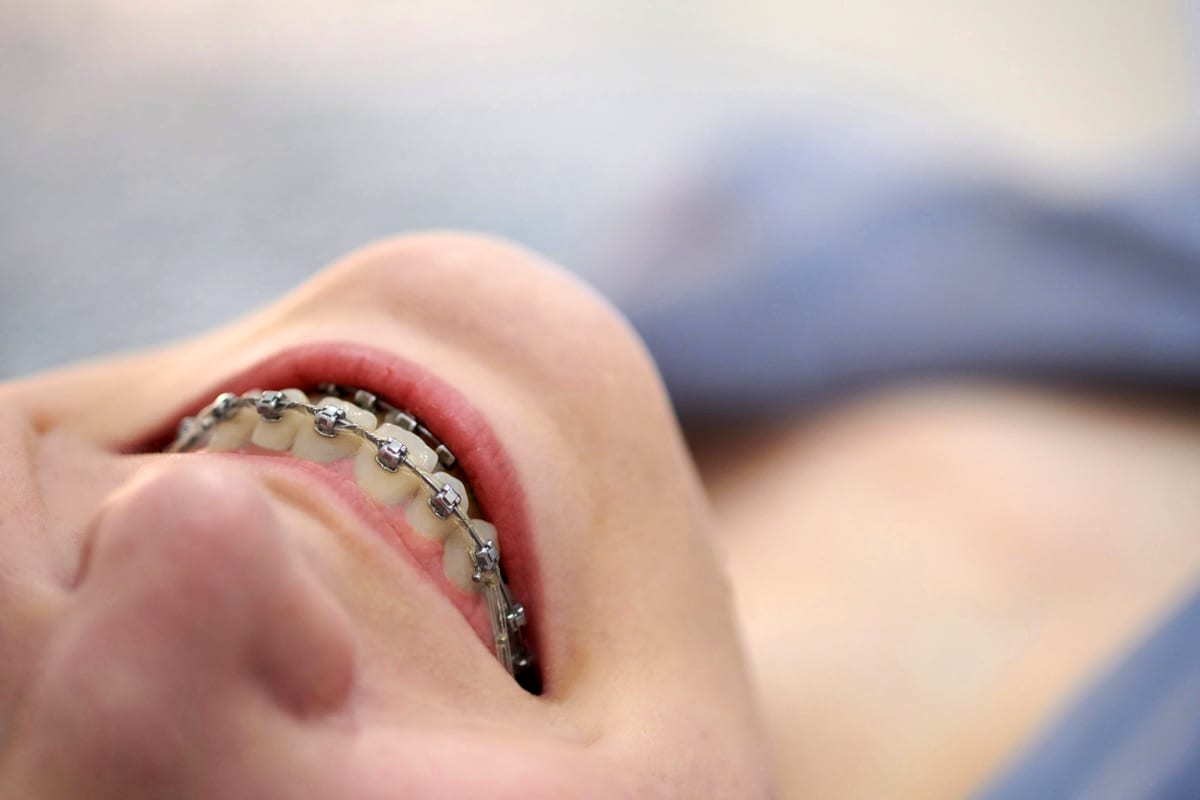 Orthodontics in Joliet